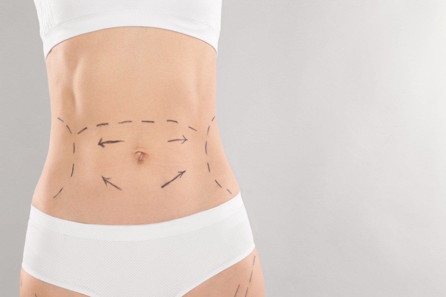 Liposuction Works