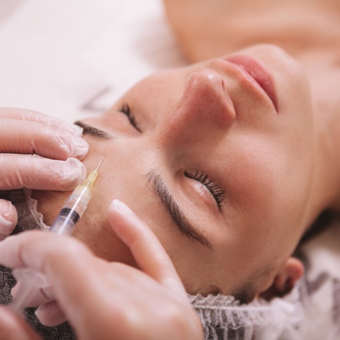 Top view close up of a woman receiving filler injections in forehead