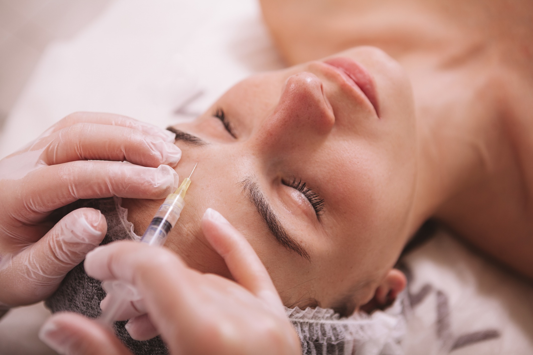 Top view close up of a woman receiving filler injections in forehead